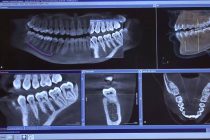 Kragujevac: Snimanje zuba u 3D